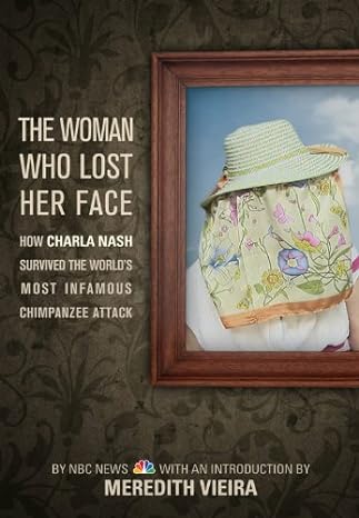 The Woman Who Lost Her Face